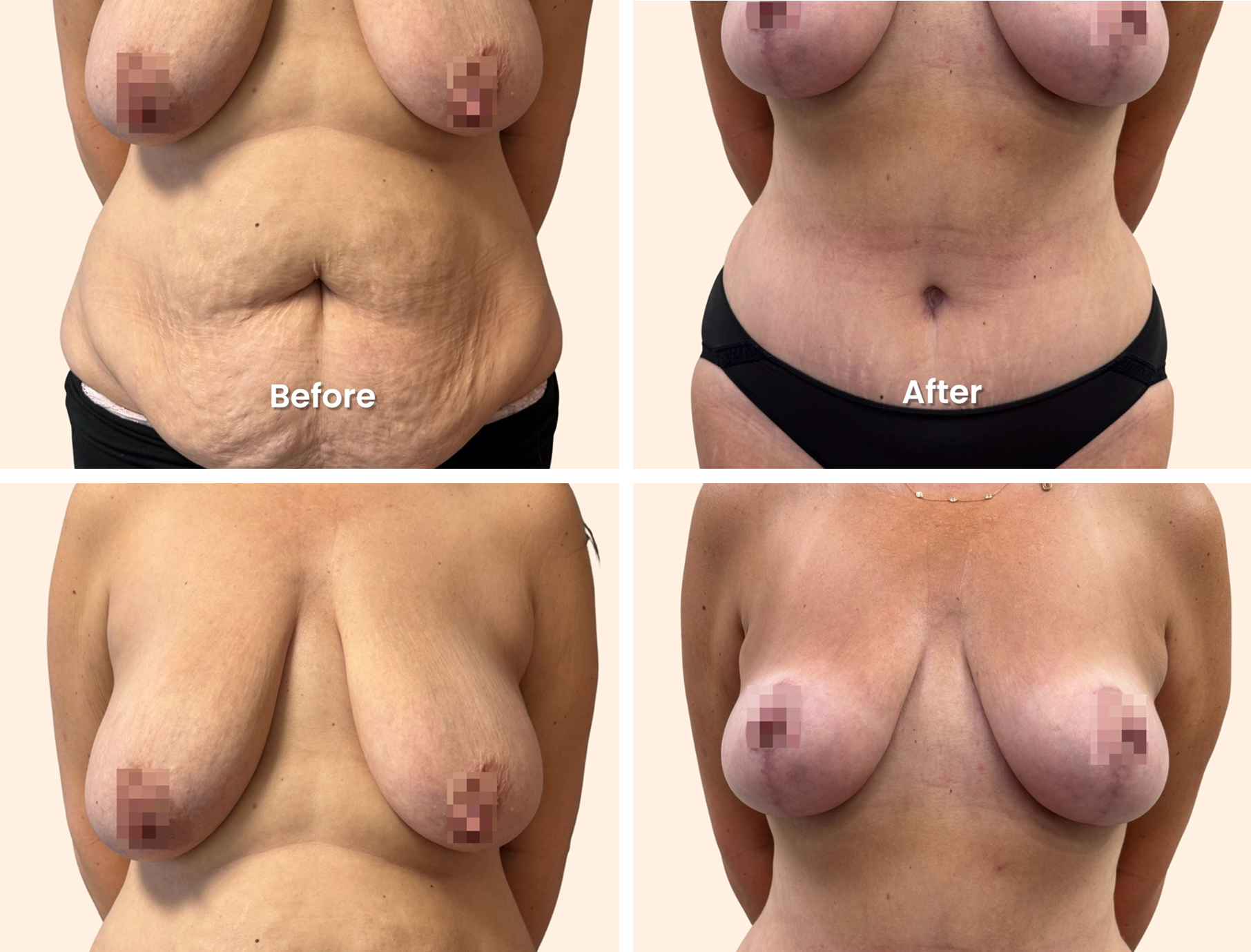 before and after